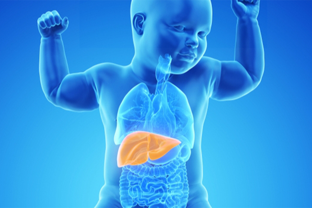 LIVER CANCER IN CHILDREN