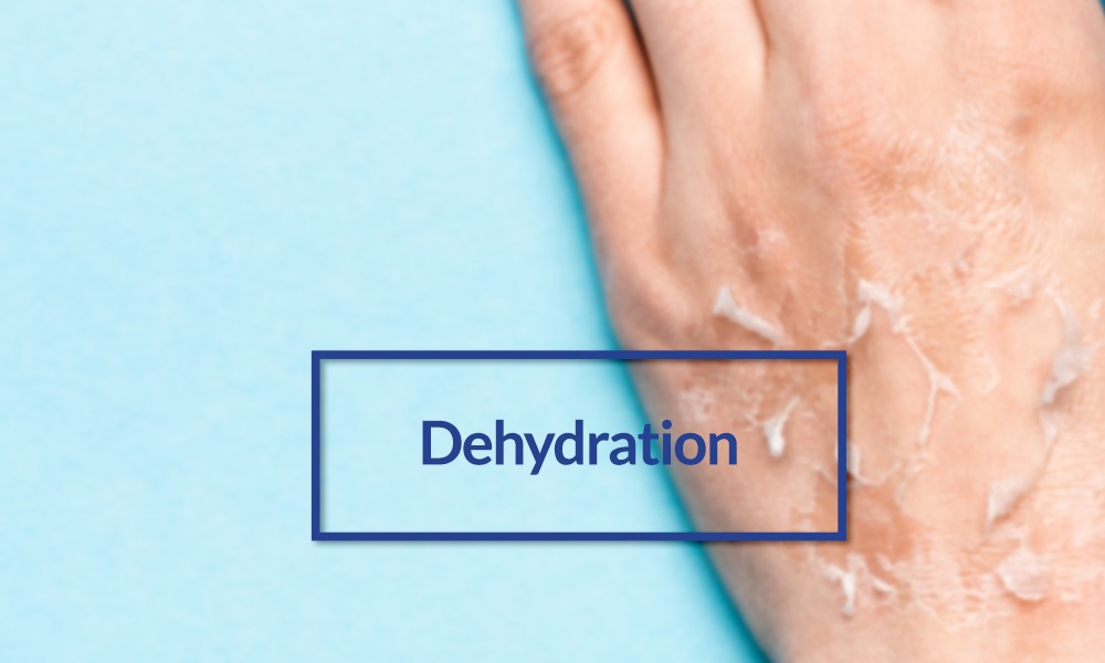 Dehydration Effects on Body