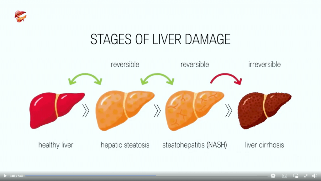Liver Infection Treatment Dr Faisal Dar