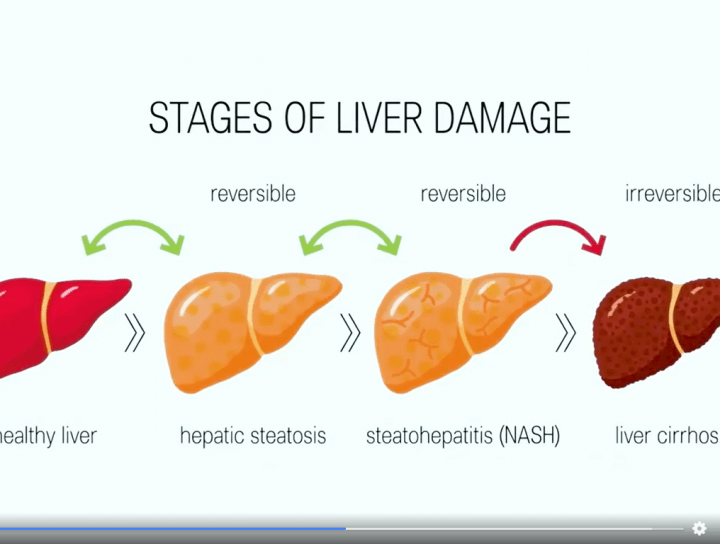 Liver Infection Treatment